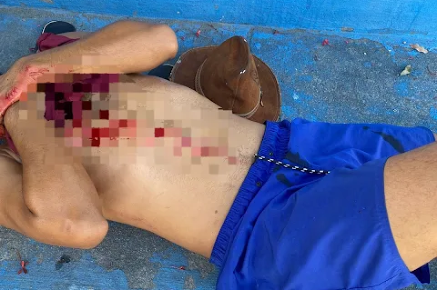 Situação de risco em espaço público - Jovem se machuca em ferro de alambrado quebrado no Campo do Gado