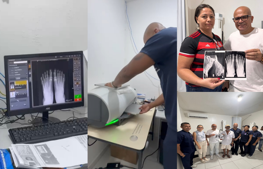 HOSPITAL MUNICIPAL SÃO SEBASTIÃO RECEBE NOVO APARELHO DE RAIO-X DIGITAL EM FILADÉLFIA